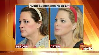 Blend Extra: Reversing the Signs of an Aging Neck