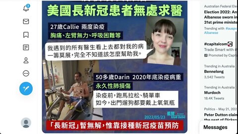 新冠肺炎後遺症的二個病例 (2)