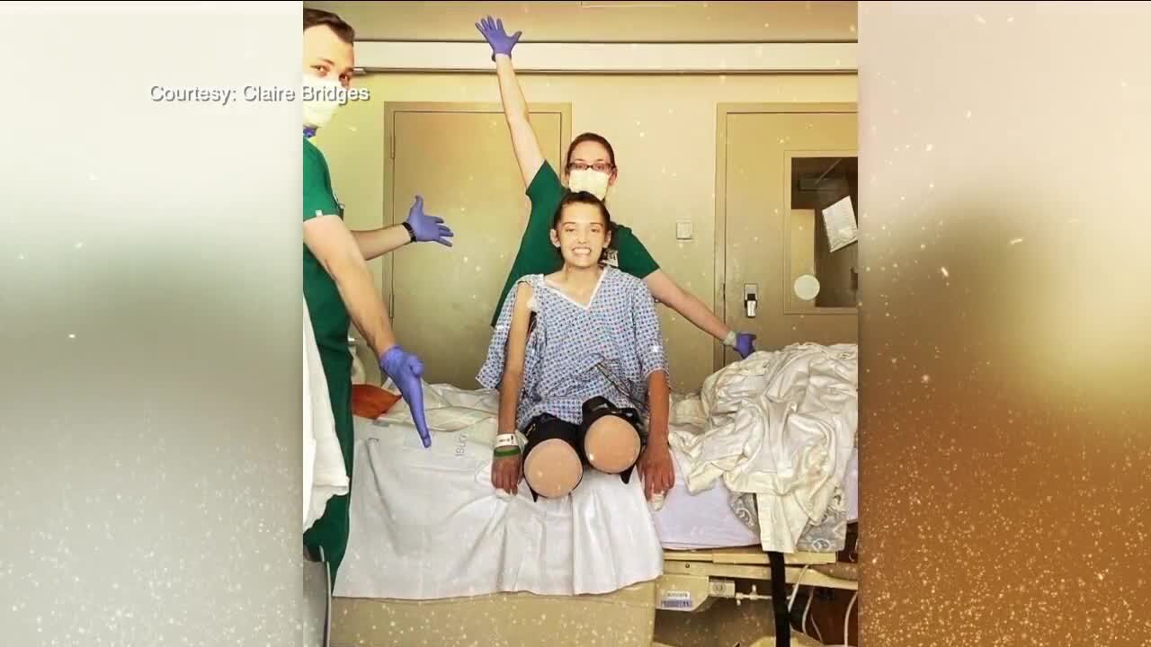 22-year-old who lost both legs after COVID complications recovers from surgery