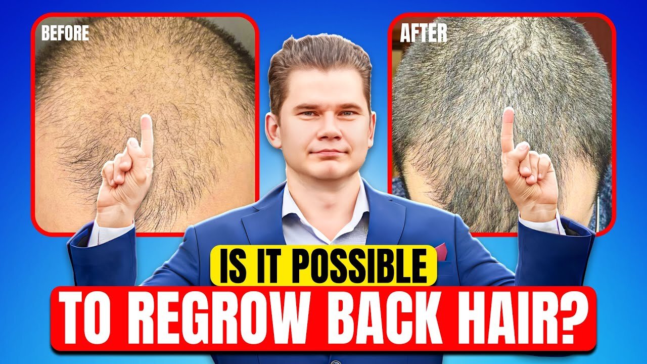 Is It Possible To Recover Hair On Completely Bald Head?