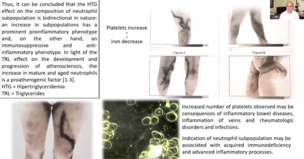 INCREDIBILE E IMPORTANTE! Imaging termografico e analisi del sangue dal vivo dopo l’iniezione di C19