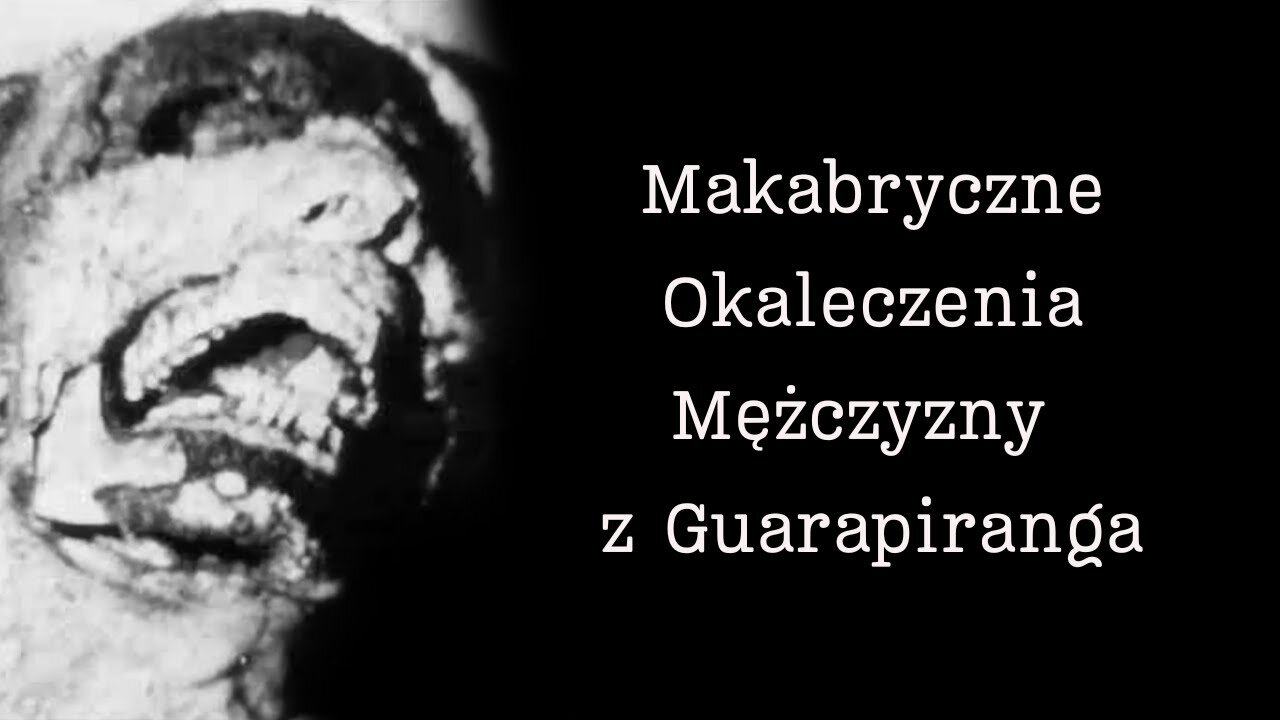 Makabryczne Okaleczenia Mężczyzny z Guarapiranga: Szokująca Prawdziwa Historia z Brazylii