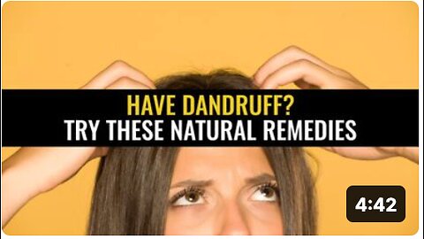 Have dandruff? Try these natural remedies