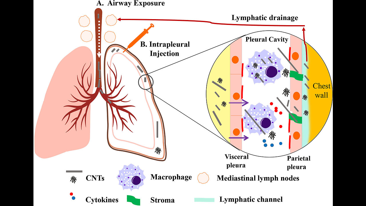 Graphene Oxide + Carbon NanoTubes in Vaccines Cause Lung Injury Like Asbestos? (NurembergTrials.net)