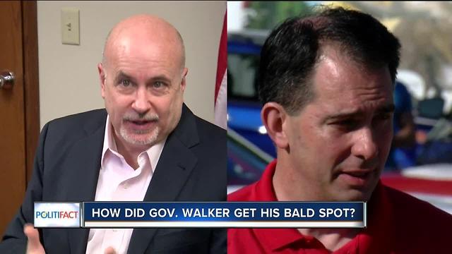 PolitiFact WI: How did Walker get his bald spot?