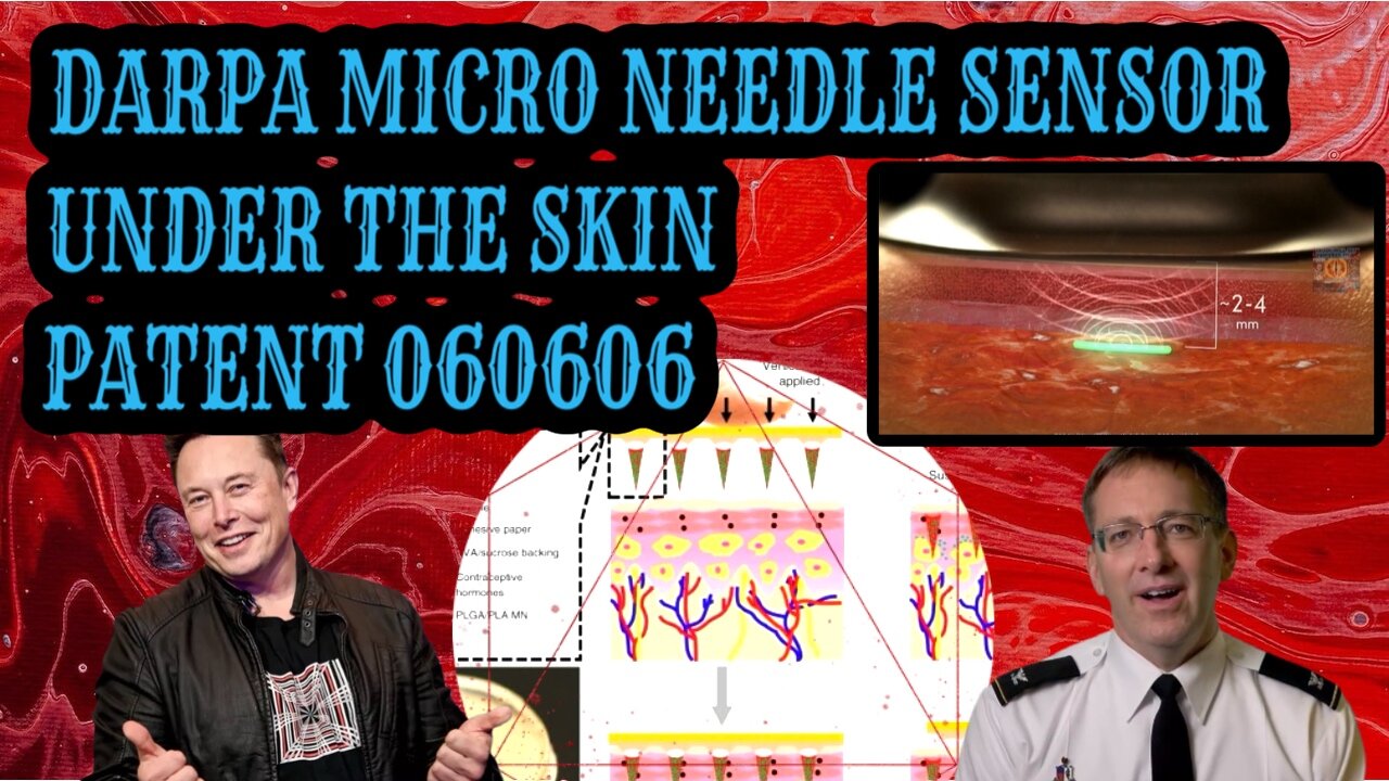 DARPA TECHNOLOGY THAT “MONITORS” YOUR HEALTH STATUS - MICRO-NEEDLE PATCH - LUMEE - PATENT 060606