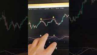 Technical Analysis 🤯🧠😎 Candlestick | Crypto | Stock | Market | Forex | Trading | #Shorts