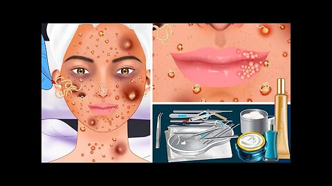 treatment of acne and freckles on a teenage girl's face | Relax With Mzogzage