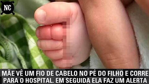 Mãe vê um fio de cabelo no pé do filho e corre para o hospital. Em seguida ela faz um alerta