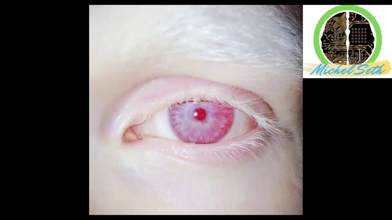 Audio Subliminal para Eliminar Melanina en los Ojos [2019]
