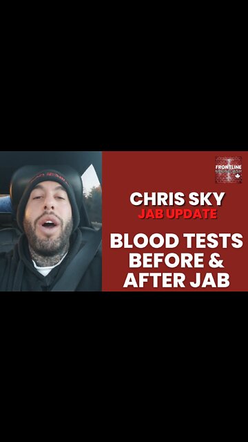 Chris Sky: JAB UPDATE - NEW SHOCKING BLOOD TESTS!