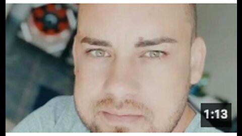 Harley Patente - Pfizer Vaccine Injury - Blood Clots, 2 Cardiac Arrests & 5 Surgeries 💉