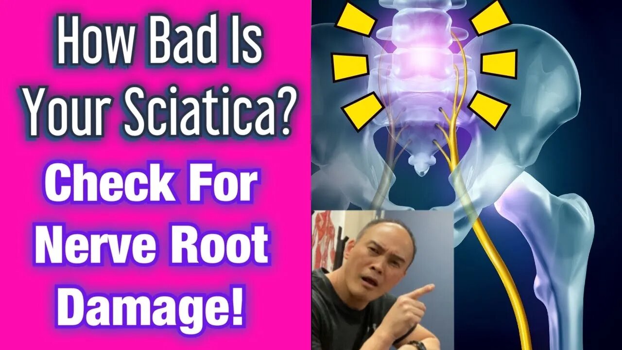 How BAD Is Your SCIATICA? Check For Nerve Root Damage! | Dr Wil & Dr K