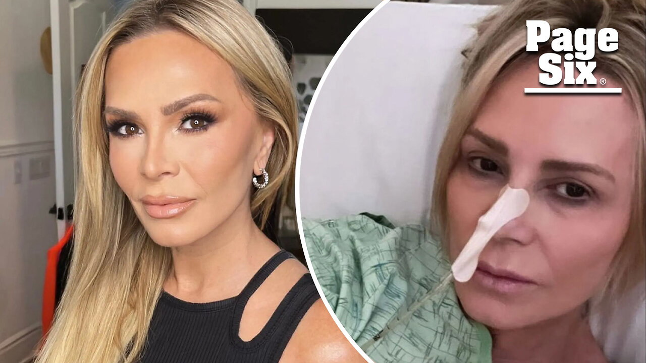 Tamra Judge hospitalized for intestinal obstruction: 'Praying I won't need surgery'