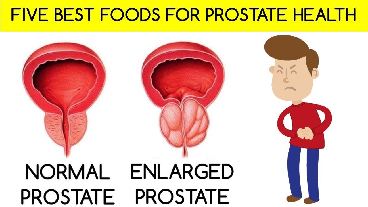 How to Shrink Enlarged Prostate with these 5 Essential Diets