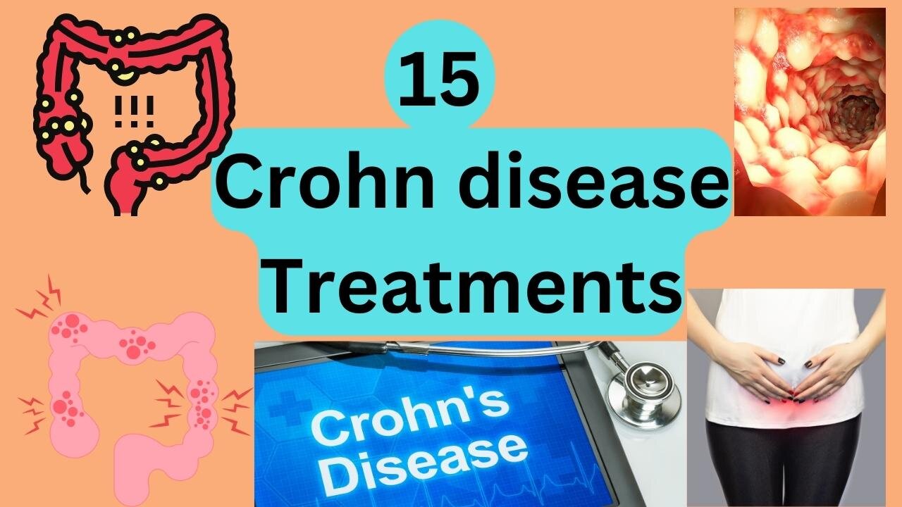 15 Crohn's disease treatments