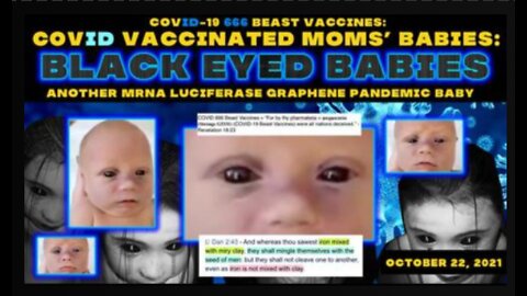COVID 666 Vaccines! Black Eyed Babies! Another MRNA Luciferase Graphene Pandemic Baby!!