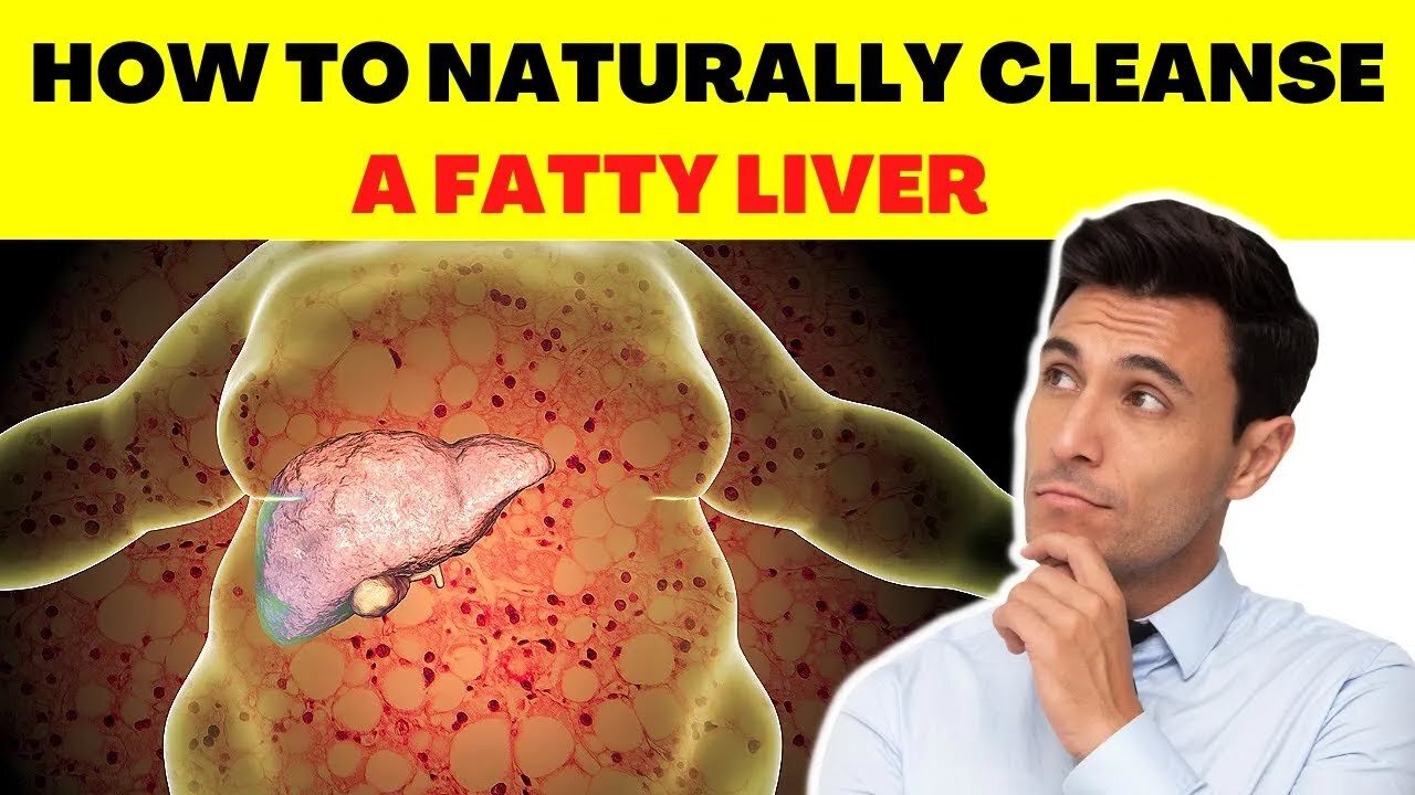 6 Absolute Foods That REVERSE a Fatty Liver Quickly