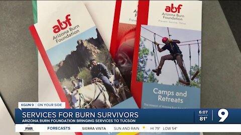 Arizona Burn Foundation bringing services to Tucson