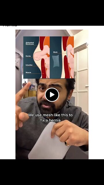 Facts about hernia🛑
