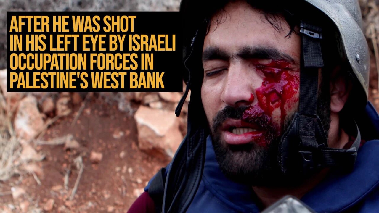 Int’l Solidarity Grows For Palestinian Photojournalist Blinded by IOF