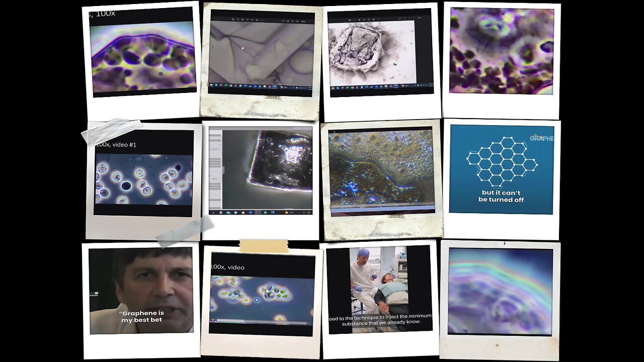 Dental anaesthetics graphene/nanotech