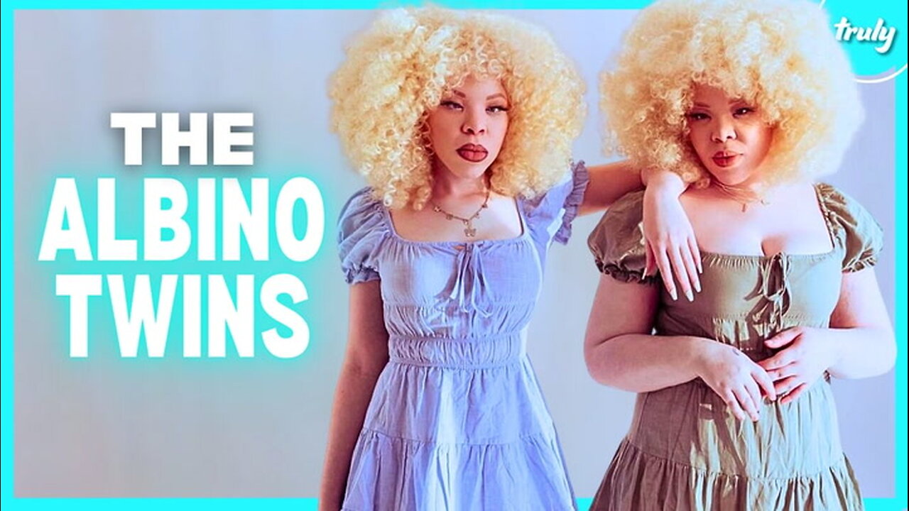 Identical Twins With Albinism Are 1 In 2 Million | BORN DIFFERENT