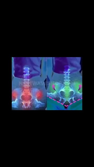 Multifunctional Orthopedic Cushion