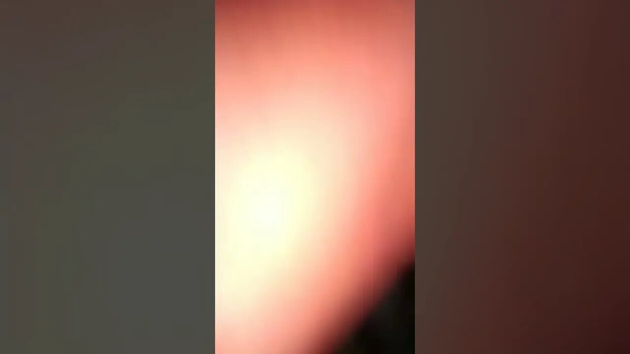 চড়ক পূজা দেখতে এসে এটা কি অবস্থা হলো
