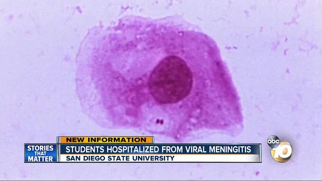 SDSU Students hospitalized from viral meningitis