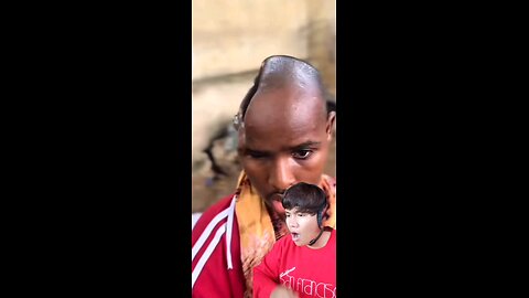 Man Survived The Impossible