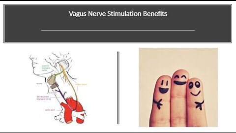 Vagus Nerve Stimulation