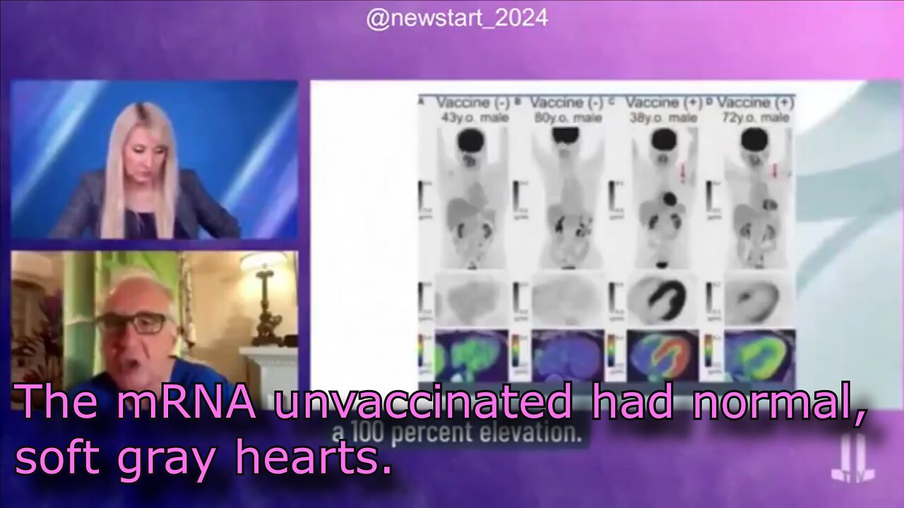 ( -0780 ) Dr. Chris Schoemaker - Japan on Verge of Approving New Self-Replicating mRNA Vaccines - Heart Damage of mRNA vaccinated, etc. (& Kamala's Important Gun Control Measures)