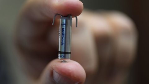 'Implant Files' Exposes Dangers Of The Global Medical Device Industry