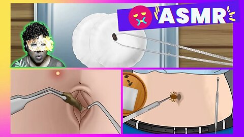 ASMR Remove Huge Navel Stone Animation 🔵 ASMR Huge Navel Stone Removal | ASMR Animation 배꼽 돌 제거