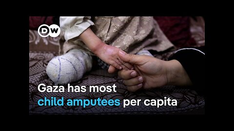 Doctors in Romania treat some of Gaza's wounded | DW News