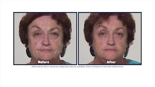Plexaderm Skincare - Midday Maryland Special February '21