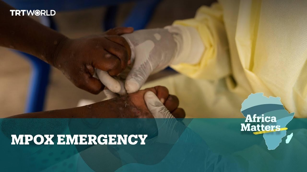 Africa Matters: Mpox Emergency