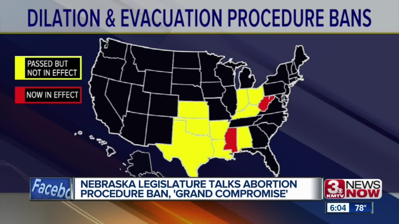 NE Legislature Talks Abortion Procedure Ban and 'Grand Compromise'