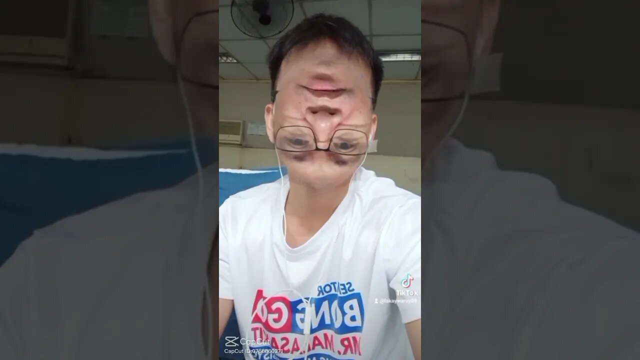 Hahaha nabaliktad Ang noo at baba