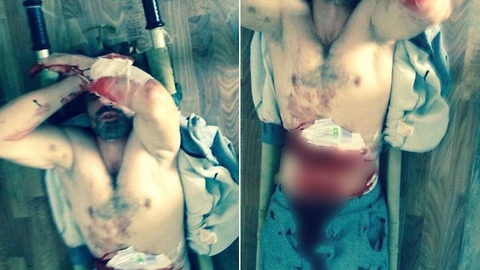 OUCH! MMA Fighter CUTS His Own Stomach in Protest of Russian Prison Treatment (GRAPHIC)