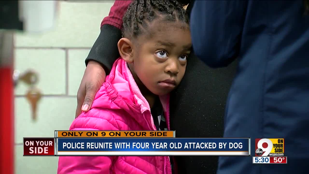Police plan special day for 4-year-old attacked by dog