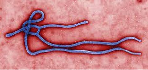 CANADIAN RESEARCHERS PROVE EBOLA IS AIRBORNE WHICH INCREASES THE THREAT TO MILLIONS