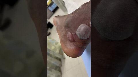 I was fired for the incident that broke both my feet “Nabis” is a evil company