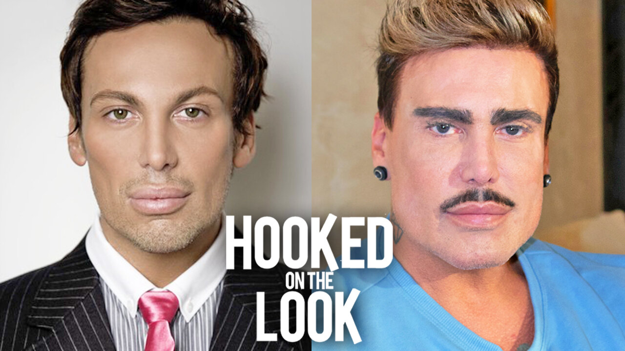 I've Been Botched - But I Won't Stop Getting Lipo | HOOKED ON THE LOOK