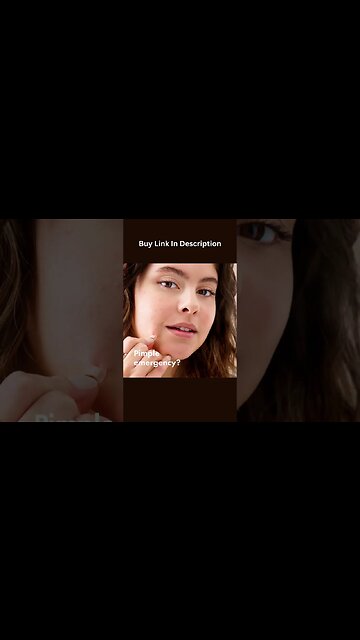 Acne Pimple Patch #acne #shorts #acnetreatment #acneremoval