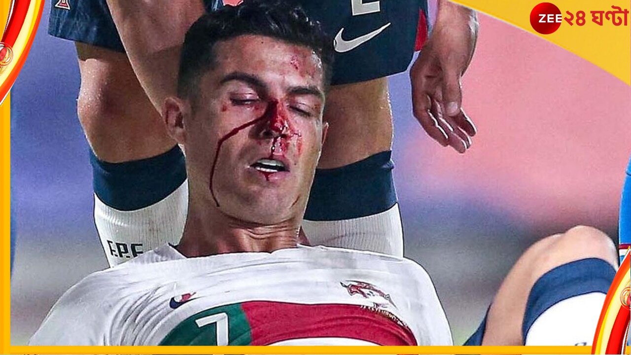 Cristiano Ronaldo BREAKS HIS NOSE vs Czech Republic