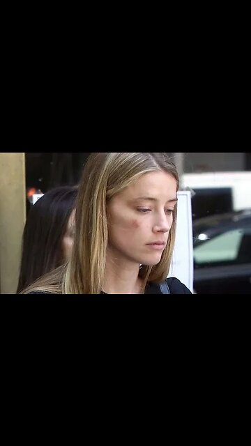 Amber Heard's Super Healing Power