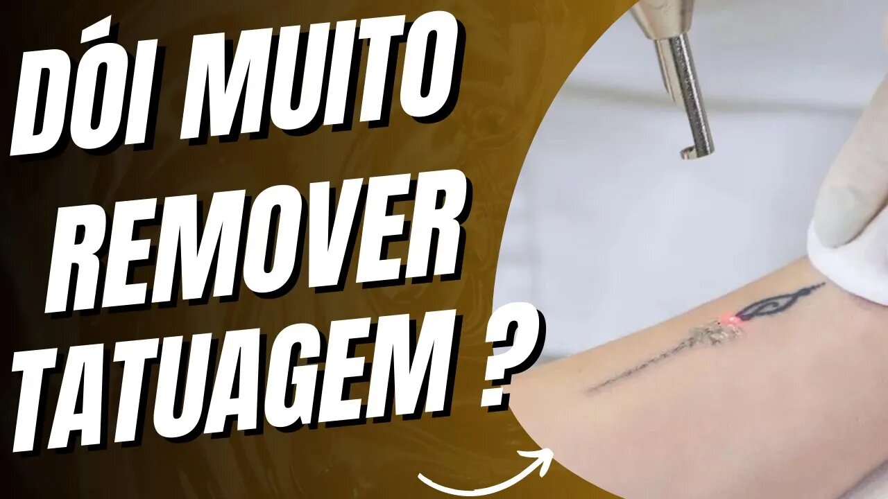 APRENDA TUDO SOBRE O PROCEDIMENTO DE REMOÇÃO DE TATUAGEM A LASER! #remoçãodetatuagem #tatuagemalaser