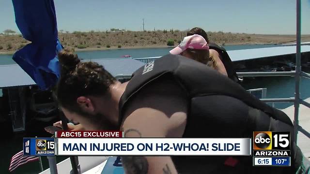 Man claims to have chipped teeth on H2-Whoa! water slide